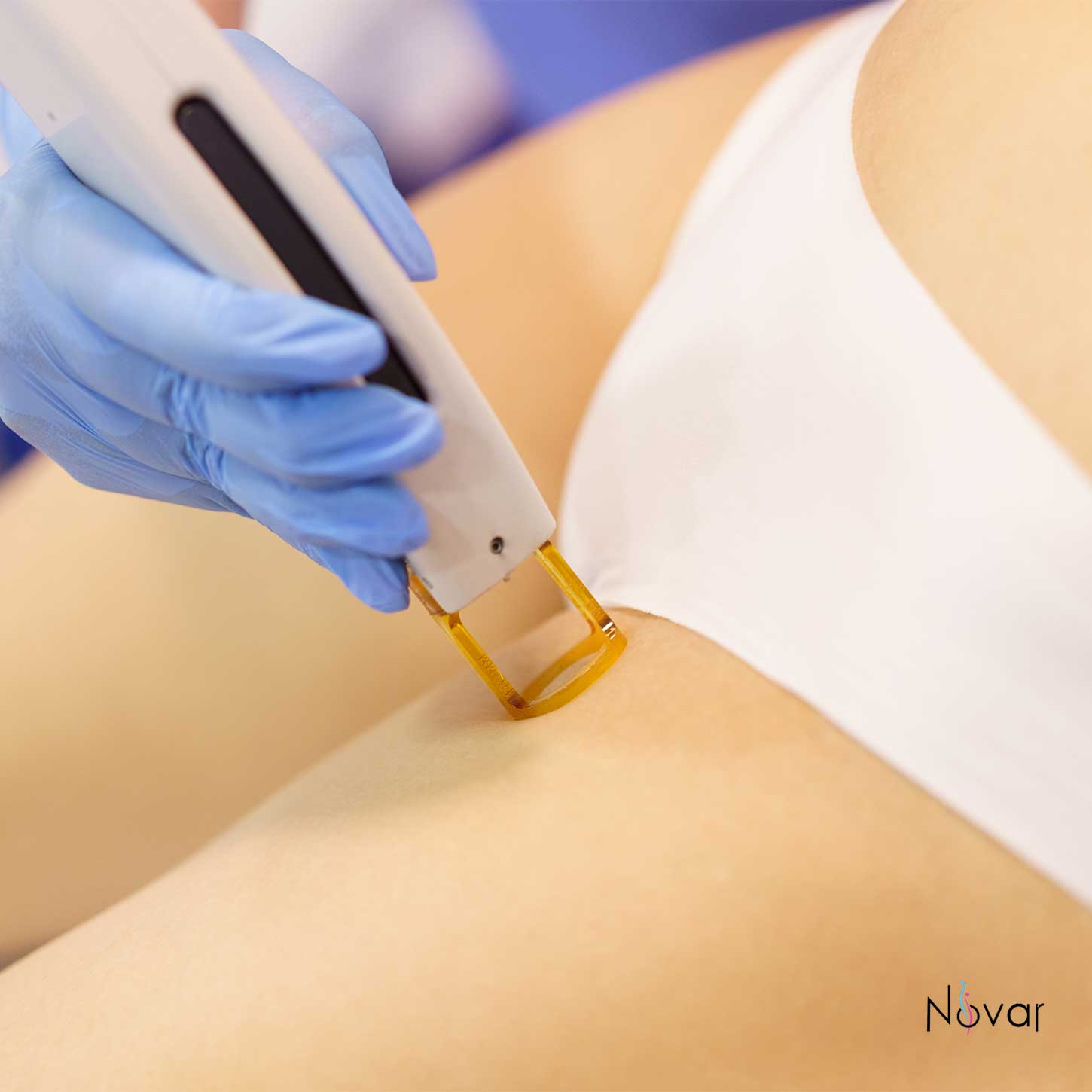 genital-bolgeye-lazer