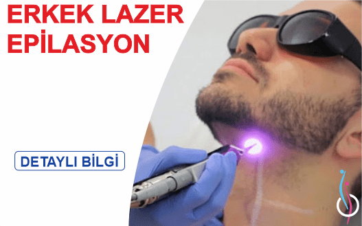 erkek lazer epilasyon-min