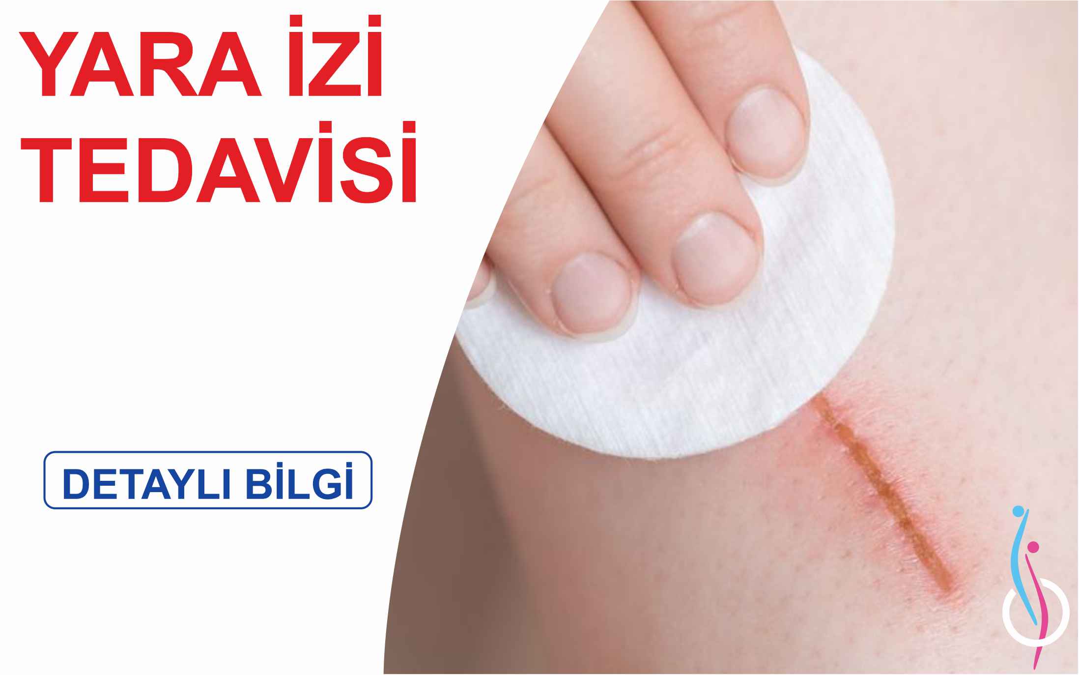 YARA İZİ TEDAVİSİ-min (1)